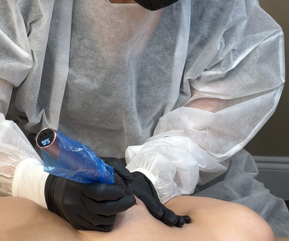 Areola 2