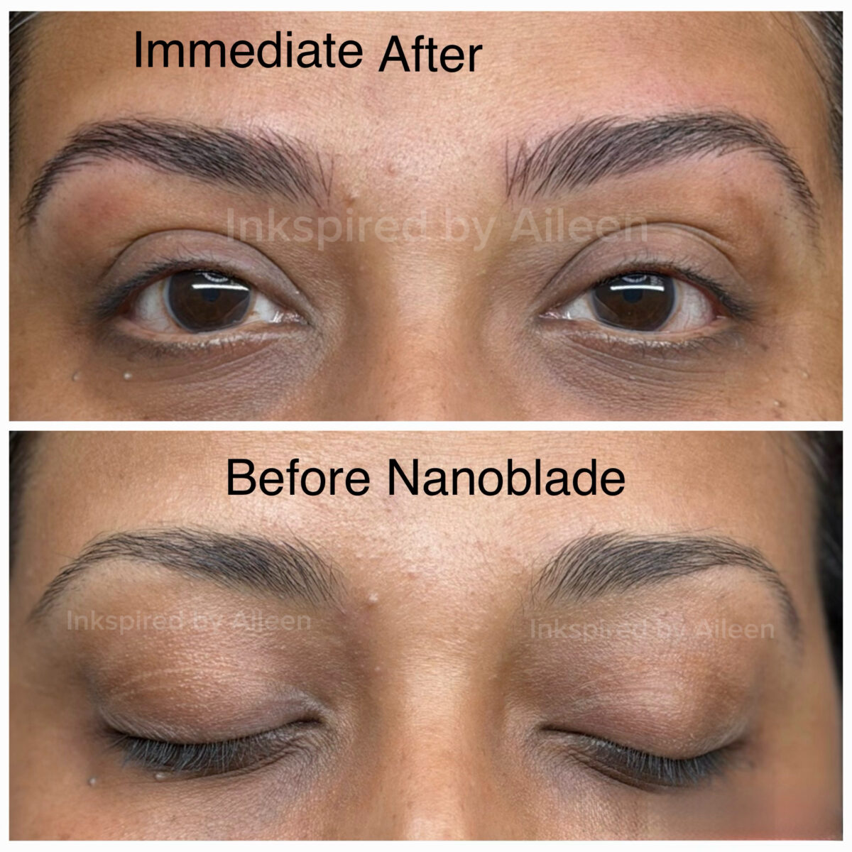 Brows