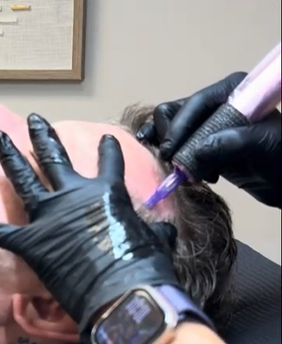 Follicure Hair Restoration
